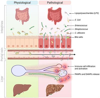 Molecular and Cellular Mediators of the Gut-Liver Axis in the Progression of Liver Diseases